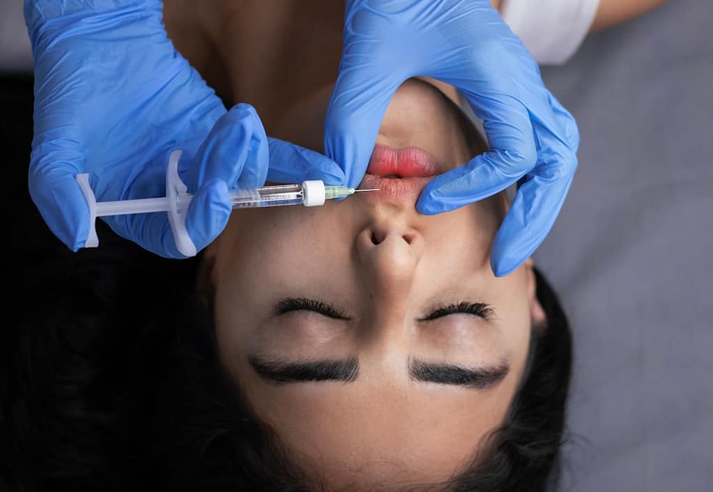 Injector administering lip filler with a syringe to a patient at a medical spa
